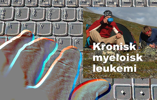 Tangentbord Pc Med Fingrar Konstnarlig Genrebild Med Kmlgenre