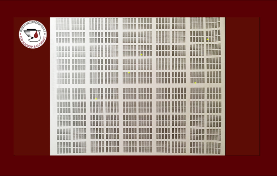 5 Av 10000 Illustration