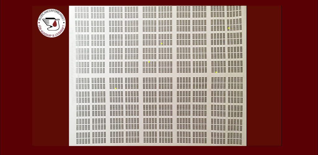 5 Av 10000 Illustration