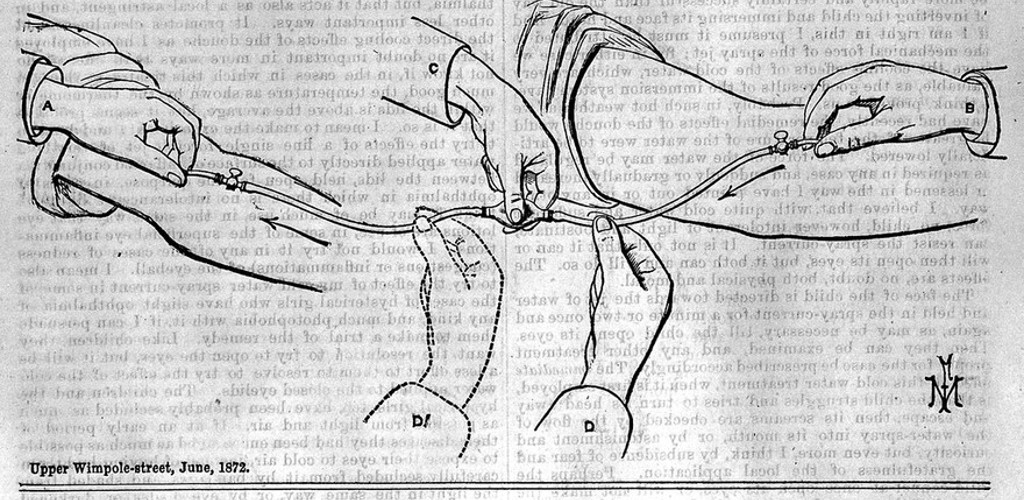 Avelings Transfusion Apparatus; The Lancet, 1872. Wellcome Collection. Source Wellcome Collection.