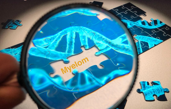 Forskning Pussel Med Fortstoringsglas Fhsj M MYELOM 1100Pxb