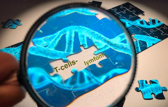 Forskning Pussel Med Fortstoringsglas Fhsj T Cellslymfom