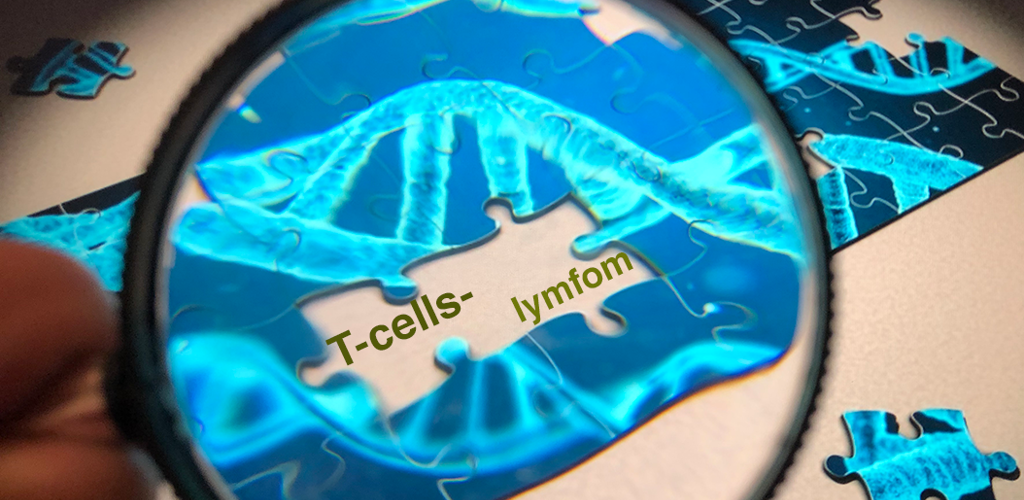 Forskning Pussel Med Fortstoringsglas Fhsj T Cellslymfom